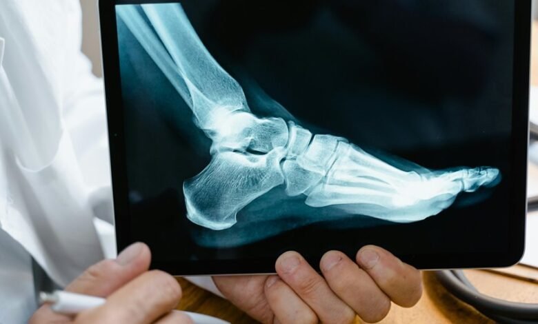 regional call source analysis